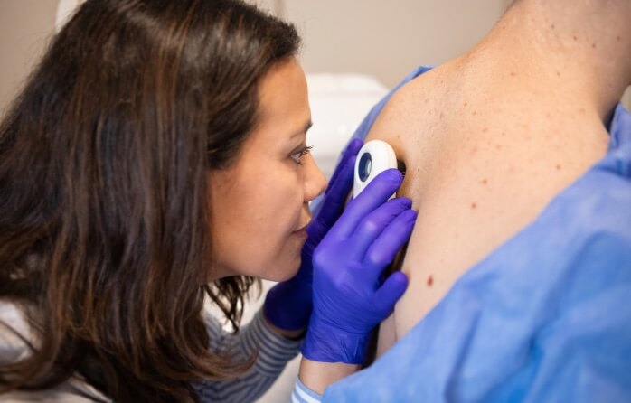 dermatologist doing skin check