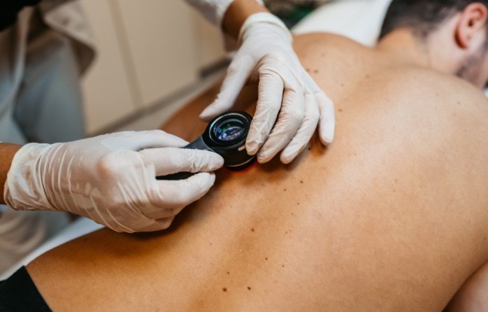 Man getting a skin cancer screening